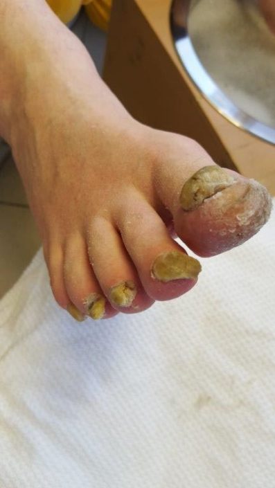 Crazy-feet Crazy-feet