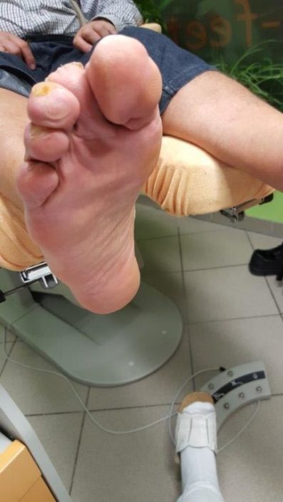 Crazy-feet Crazy-feet