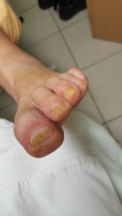 Crazy-feet Crazy-feet