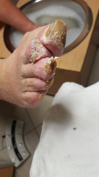 Crazy-feet Crazy-feet