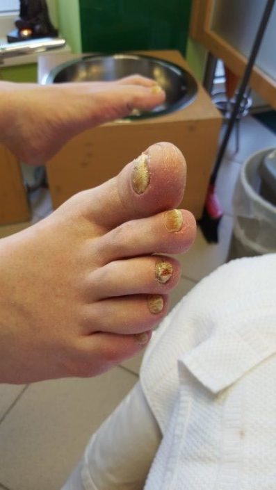 Crazy-feet Crazy-feet