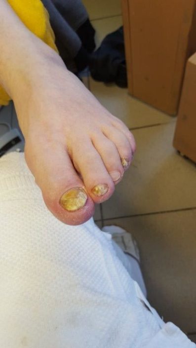 Crazy-feet Crazy-feet